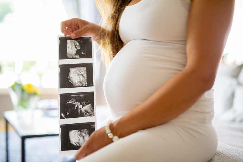 A pregnant woman holding ultrasound images
